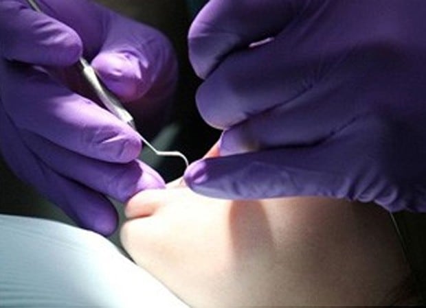 Clínica odontológica no Distrito Federal é condenada a pagar R$ 20 mil de indenização por extrair dente errado de paciente