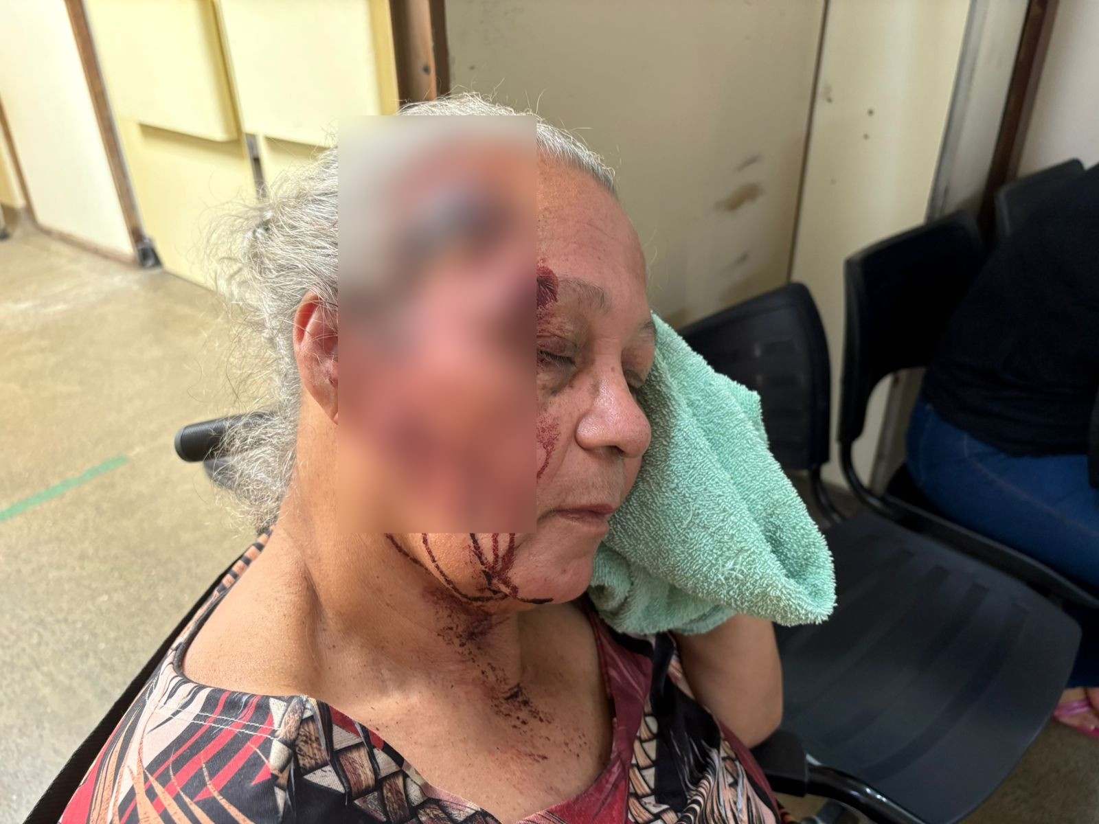 Idosa cai e bate a cabeça após descer de ônibus no DF; motorista não prestou socorro